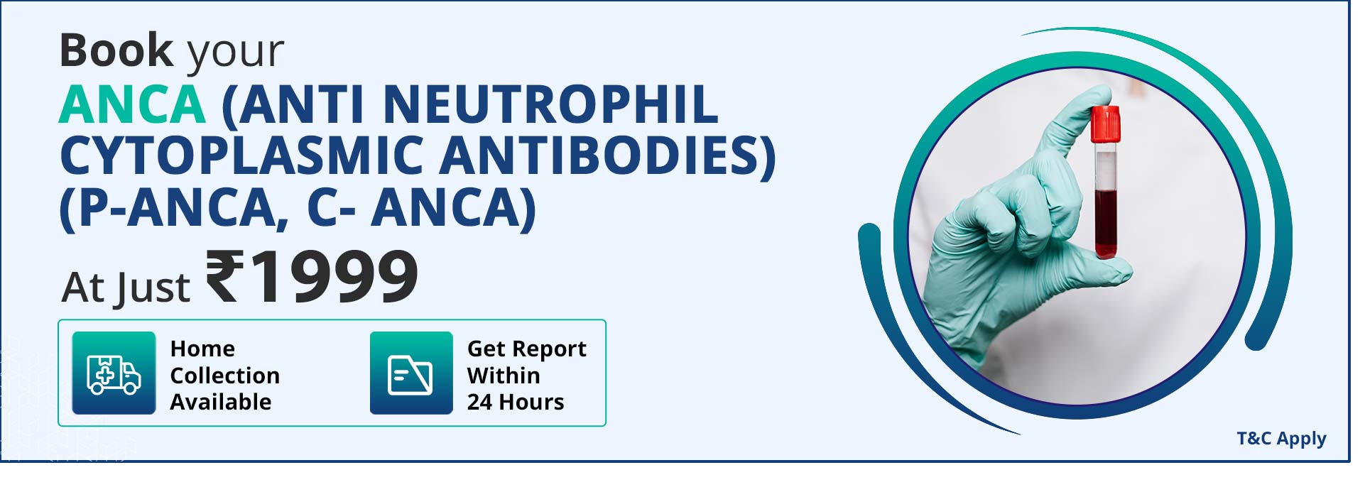 ANCA (Anti Neutrophil Cytoplasmic Antibodies) (P-ANCA, C- ANCA)